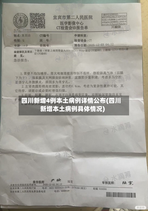 四川新增4例本土病例详情公布(四川新增本土病例具体情况)-第1张图片