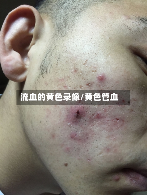 流血的黄色录像/黄色管血-第2张图片