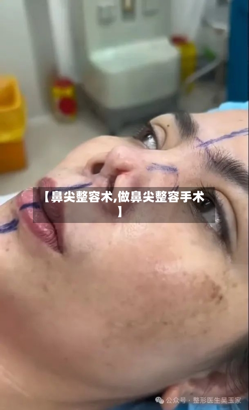 【鼻尖整容术,做鼻尖整容手术】-第1张图片