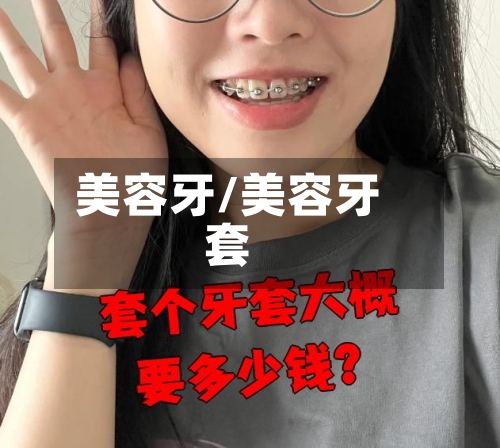 美容牙/美容牙套-第1张图片