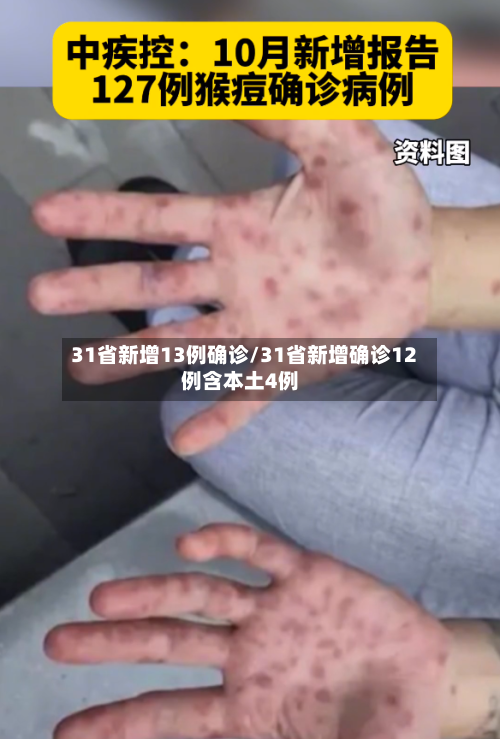 31省新增13例确诊/31省新增确诊12例含本土4例-第1张图片