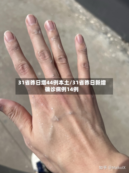 31省昨日增44例本土/31省昨日新增确诊病例14例-第1张图片