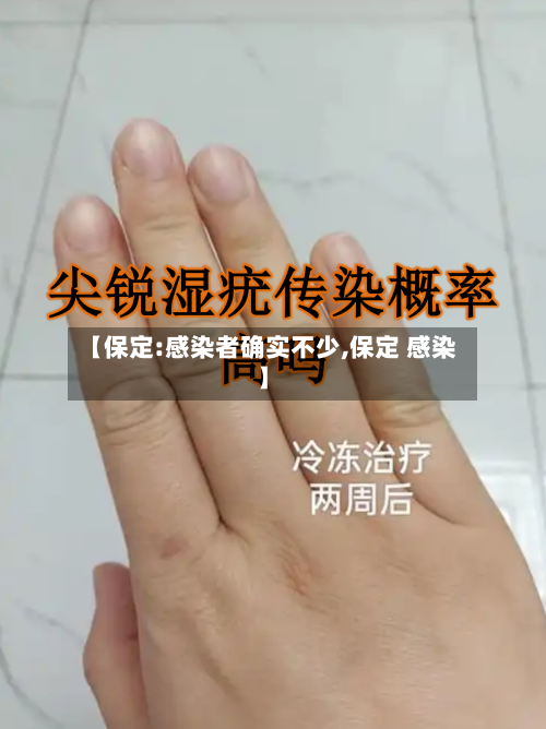 【保定:感染者确实不少,保定 感染】-第1张图片